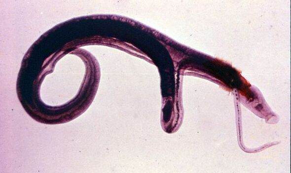 Skistosoomid on üks levinumaid ja ohtlikumaid parasiite